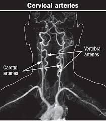 Two pairs of blood vessels in the neck — the carotid and vertebral arteries, known collectively as the cervical arteries — carry blood to the brain. When A Pain In The Neck Is Serious Harvard Health