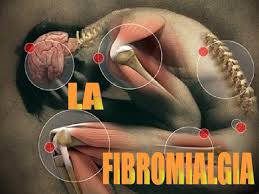Resultado de imagen de fibromialgia