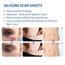 silicone scar sheets tape roll