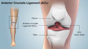 acl injury shown and explained using 3d