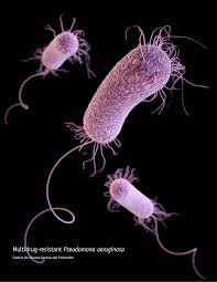 some antibiotic resistant bacteria have