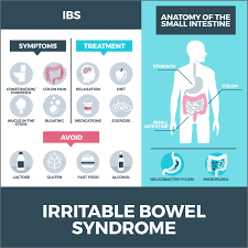 irritable bowel syndrome gastro md