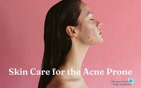 skin care for the acne e advanced