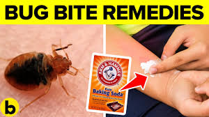 13 natural bug bite remes that work