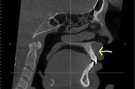 cone beam ct imaging springfield mo