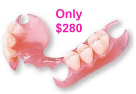 dentures affordable flexible partials