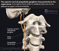 cranial neuralgias symptoms of pain