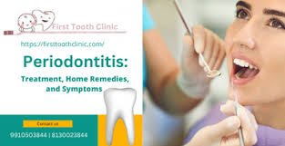 periodonis treatment home remes