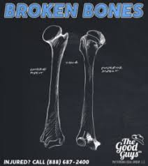 Broken Bones And Fractures Injury Claim Value Should You