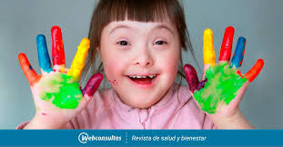 Down syndrome or down's syndrome, also known as trisomy 21, is a genetic disorder caused by the presence of all or part of a third copy of chromosome 21. Dia Mundial Del Sindrome De Down Cambia Tu Mirada