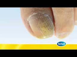 scholl fungal nail treatment you