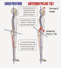 the thigh muscle back pain connection