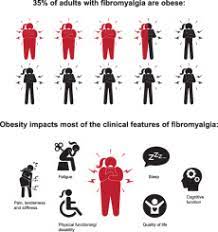 fibromyalgia and obesity a