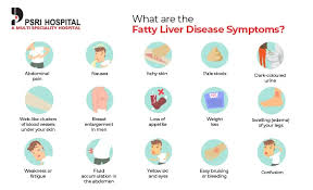 fatty liver symptoms causes