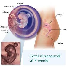 Fetal Ultrasound 2 Months Babycentre Uk
