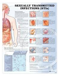 Sexually Transmitted Infections Anatomical Chart