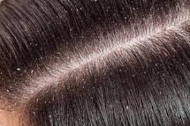 Trycholog wyspecjalizowany w leczeniu schorzeń związanych z włosami oraz skórą głowy, a także pielęgnacją i trychoregeneracją włosów. Dobry Trycholog Wroclaw Krzyki Na Czym Polega Badanie Trychologiczne