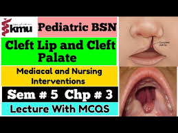 cleft lip and cleft palate pediatric