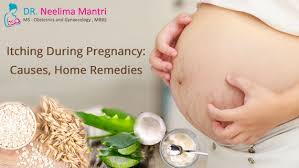 itching during pregnancy causes home
