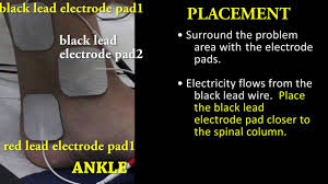 Specific Examples For Placement Of Pads For The Tens Unit