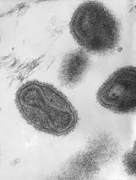 Image result for Eradication of Smallpox Is Certified (1979)