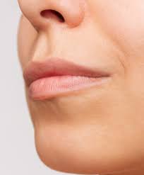 upper thin lips treatment in
