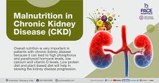 malnutrition in chronic kidney disease