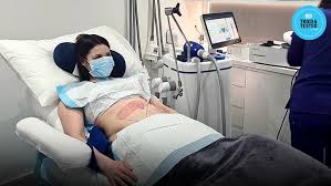 coolsculpting elite review can it
