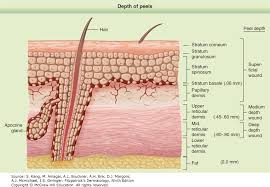 Chemical Peels And Dermabrasion Fitzpatricks Dermatology