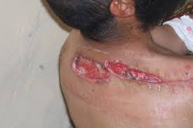 In addition to determination of bullet caliber (diameter) and type, . This Happens When A 50cal Round Merely Grazes Skin Wtf