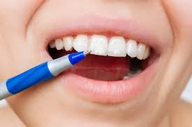 white spots on teeth causes treatment