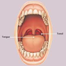 Any mass in the throat needs to be seen. Mouth And Throat Cancer Seasons Of Smiles Dental Arthur Norman Medina Dds