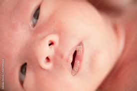 newborn baby is dry chapped lips