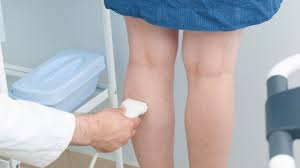 the truth about varicose veins