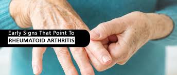 This may then progress to the knees, feet, ankles or shoulders too. Early Signs That Point To Rheumatoid Arthritis Medicover Hospitals