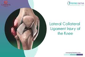 lateral collateral ligament lcl injury