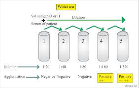 Positive Widal Test Normal Range Chart Www