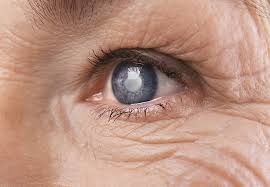cataract morgantown wv eye clinic