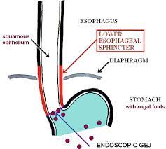 lower esophageal sphincter damage