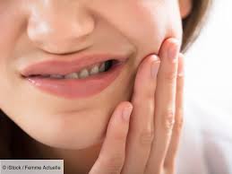 Quelles sont les causes de la rage de dents ? Douleur Dentaire Comment Soulager Une Rage De Dents Femme Actuelle Le Mag