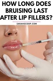 after lip fillers swelling tip