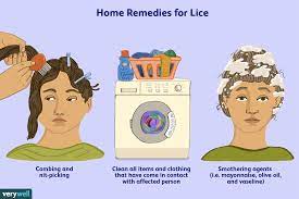 how head lice is treated