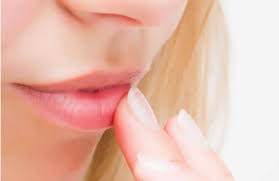 Auch in diesem bereich können bläschen auftreten, sie werden als aphten bezeichnet. Herpes Alles Zum Thema Lippenherpes Lippenherpes Ratgeber