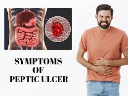 ulcer can be painful symptoms you