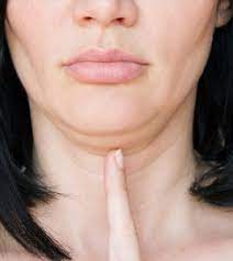 exercises to get rid of double chin