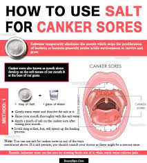 how does salt help heal canker sores