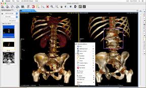 Dicom (digital imaging and communications in medicine) is a standard format that enables medical professionals to view, store, and share medical images irrespective of their geographic location. Weasis Medical Viewer Weasis Documentation