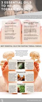 3 essential oils to help toenail fungus