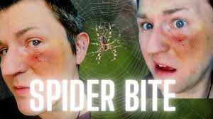 spider bite arachnophobia inspired
