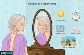 crepey skin causes symptoms